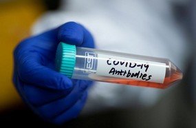 Cientistas chineses anunciam descoberta contra coronavírus