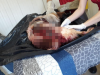 Morre cachorro que pode ter sido arrastado por automóvel