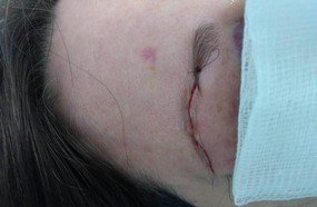 Gerência de educação emite nota sobre agressão a professora