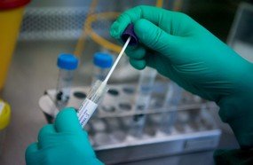 Nove casos suspeitos foram descartados em Joaçaba