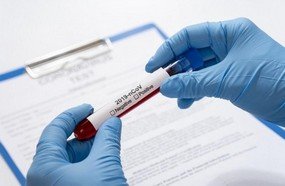 Médicos que foram infectados pelo coronavírus estão recuperados